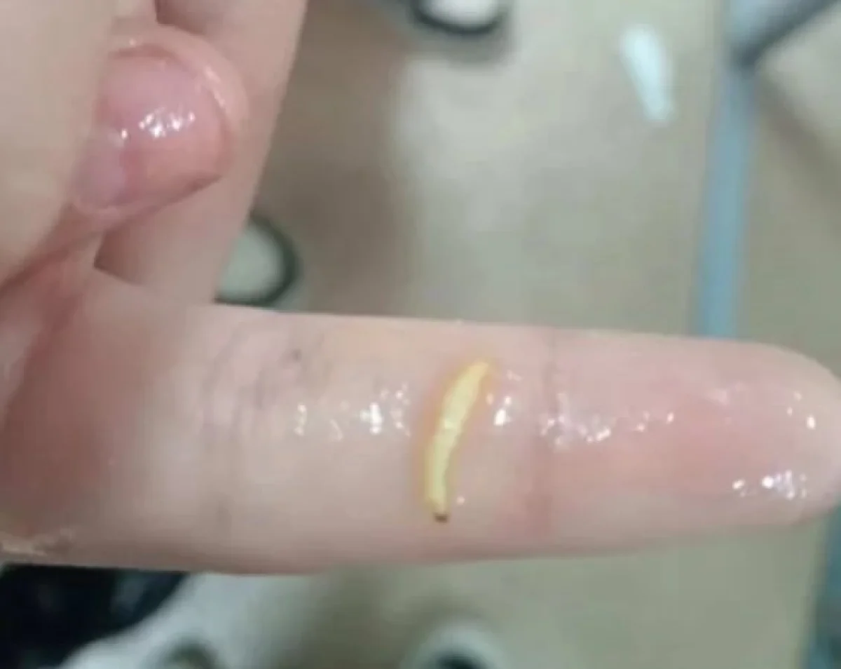 В ВКО детей кормили червями? Шокирующее фото разлетелось по Казнету