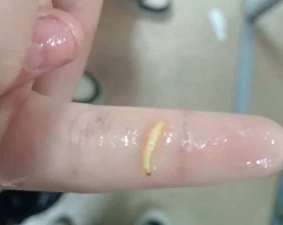 В ВКО детей кормили червями? Шокирующее фото разлетелось по Казнету